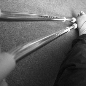 Podcast #38: How Not to Treat a&nbsp;Burn