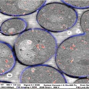 Podcast #45: Overly&nbsp;Candida